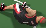 Ankle injury 3